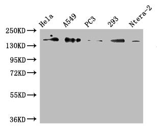 Western Blot Positive WB detected in: Hela whole cell lysate, A549 whole cell lysate, PC3 whole cell lysate, 293 whole cell lysate, Ntera-2 whole cell lysate All lanes: DUOX2 antibody at 1:500 Secondary Goat polyclonal to rabbit IgG at 1/50000 dil...