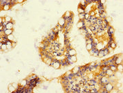 Immunohistochemistry of paraffin-embedded human small intestine tissue using CSB-PA007229ESR2HU at dilution of 1:100