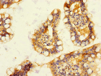 Immunohistochemistry of paraffin-embedded human small intestine tissue using CSB-PA007229ESR2HU at dilution of 1:100