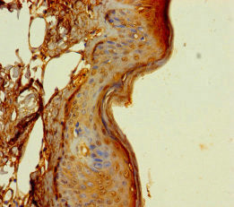 Immunohistochemistry of paraffin-embedded human skin tissue using CSB-PA007237LA01HU at dilution of 1:100