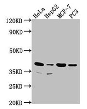 Western Blot Positive WB detected in: Hela whole cell lysate, HepG2 whole cell lysate, MCF-7 whole cell lysate, PC3 whole cell lysate All lanes: DUSP11 antibody at 1:2000 Secondary Goat polyclonal to rabbit IgG at 1/50000 dilution Predicted band s...