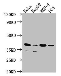 Western Blot Positive WB detected in: Hela whole cell lysate, HepG2 whole cell lysate, MCF-7 whole cell lysate, PC3 whole cell lysate All lanes: DUSP11 antibody at 1:2000 Secondary Goat polyclonal to rabbit IgG at 1/50000 dilution Predicted band s...