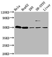 Western Blot Positive WB detected in: Hela whole cell lysate, HepG2 whole cell lysate, 293 whole cell lysate, SH-SY5Y whole cell lysate, Mouse liver tissue All lanes: DYM antibody at 3.7µg/ml Secondary Goat polyclonal to rabbit IgG at 1/50000 dilu...