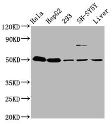 Western Blot Positive WB detected in: Hela whole cell lysate, HepG2 whole cell lysate, 293 whole cell lysate, SH-SY5Y whole cell lysate, Mouse liver tissue All lanes: DYM antibody at 3.7µg/ml Secondary Goat polyclonal to rabbit IgG at 1/50000 dilu...