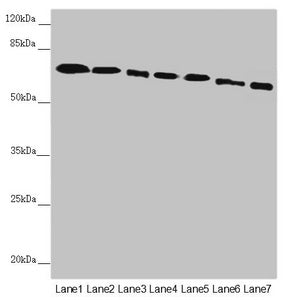 Western blot All lanes: DYNC1I1 antibody at 2.52µg/ml Lane 1: Mouse brain tissue Lane 2: Mouse gonadal tissue Lane 3: K562 whole cell lysate Lane 4: HL60 whole cell lysate Lane 5: Mouse lung tissue Lane 6: Mouse skeletal muscle tissue Lane 7: Mous...