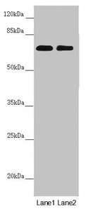 Western blot All lanes: DYNC1I1 antibody at 1.97 ug/ml Lane 1: Mouse brain tissue Lane 2: Mouse gonadal tissue Secondary Goat polyclonal to rabbit IgG at 1/10000 dilution Predicted band size: 73, 71, 69, 68 kDa Observed band size: 73 kDa