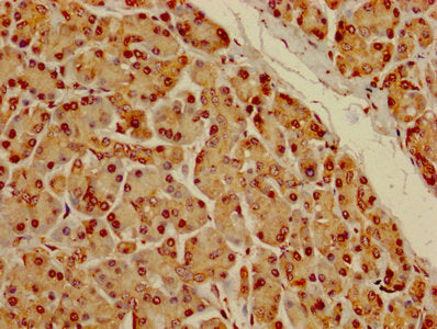 IHC image of CSB-PA007312LA01HU diluted at 1:100 and staining in paraffin-embedded human pancreatic tissue performed on a Leica BondTM system. After dewaxing and hydration, antigen retrieval was mediated by high pressure in a citrate buffer (pH 6....