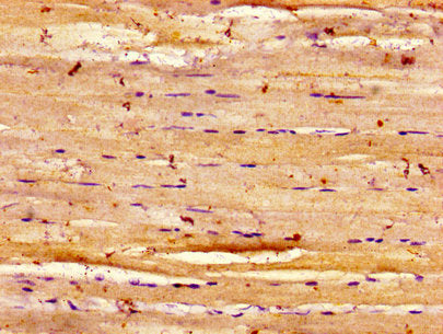 Immunohistochemistry of paraffin-embedded human skeletal muscle tissue using CSB-PA007314LA01HU at dilution of 1:100