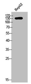 Western Blot analysis of HepG2 cells using Phospho-c-Fms (Y561) Polyclonal Antibody