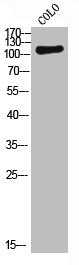 Western Blot analysis of COLO cells using c-Fms Polyclonal Antibody
