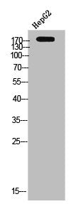 Western Blot analysis of HepG2 cells using c-Fms Polyclonal Antibody