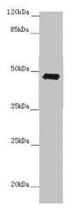 Western blot All lanes: E2F1 antibody at 7 µg/ml + 3T3 whole cell lysate Secondary Goat polyclonal to rabbit IgG at 1/10000 dilution Predicted band size: 47 kDa Observed band size: 47 kDa