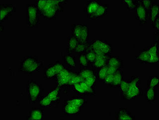 Immunofluorescent analysis of HepG2 cells using CSB-PA007342LA01HU at dilution of 1:100 and Alexa Fluor 488-congugated AffiniPure Goat Anti-Rabbit IgG(H+L)