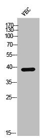 Western Blot analysis of VEC cells using Phospho-Casein Kinase Iα (Y321) Polyclonal Antibody