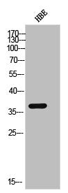 Western Blot analysis of HBE cells using Phospho-Casein Kinase Iα (Y294) Polyclonal Antibody