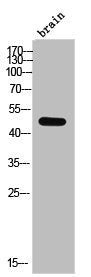 Western Blot analysis of brain cells using Casein Kinase Iδ Polyclonal Antibody