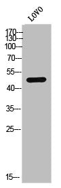 Western Blot analysis of LOVO cells using Casein Kinase Iε Polyclonal Antibody
