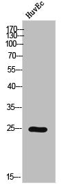 Western Blot analysis of HuvEc cells using Phospho-Casein Kinase IIβ (S209) Polyclonal Antibody