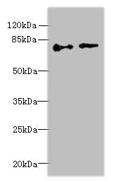 Western blot All lanes: ECD antibody at 6µg/ml Lane 1: Hela whole cell lysate Lane 2: U251 whole cell lysate Secondary Goat polyclonal to rabbit IgG at 1/10000 dilution Predicted band size: 73, 68, 77 kDa Observed band size: 73 kDa