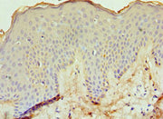 Immunohistochemistry of paraffin-embedded human skin tissue using CSB-PA007371ESR2HU at dilution of 1:100