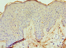 Immunohistochemistry of paraffin-embedded human skin tissue using CSB-PA007371ESR2HU at dilution of 1:100