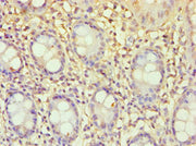 Immunohistochemistry of paraffin-embedded human colon tissue using CSB-PA007372ESR2HU at dilution of 1:100
