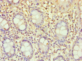 Immunohistochemistry of paraffin-embedded human colon tissue using CSB-PA007372ESR2HU at dilution of 1:100