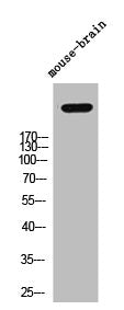 Western Blot analysis of mouse-brain cells using Versican Polyclonal Antibody