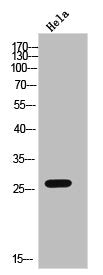 Western Blot analysis of HELA cells using CMTM4 Polyclonal Antibody