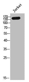 Western Blot analysis of Jk cells using Neurocan Polyclonal Antibody