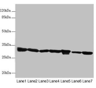 Western blot All lanes: ECHS1 antibody at 3.03µg/ml Lane 1: Mouse liver tissue Lane 2: Mouse skeletal muscle tissue Lane 3: Hela whole cell lysate Lane 4: HepG2 whole cell lysate Lane 5: MCF-7 whole cell lysate Lane 6: Jurkat whole cell lysate Lan...