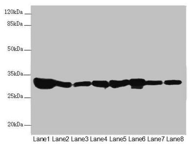 Western blot All lanes: ECHS1 antibody at 3.55µg/ml Lane 1: Rat heart tissue Lane 2: Mouse liver tissue Lane 3: Mouse skeletal muscle tissue Lane 4: Hela whole cell lysate Lane 5: HepG2 whole cell lysate Lane 6: MCF-7 whole cell lysate Lane 7: Jur...