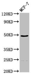 Western Blot Positive WB detected in: MCF-7 whole cell lysate All lanes: ECM1 antibody at 4.5µg/ml Secondary Goat polyclonal to rabbit IgG at 1/50000 dilution Predicted band size: 61, 47, 20, 64 kDa Observed band size: 47 kDa