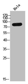 Western Blot analysis of HeLa cells using TMC8 Polyclonal Antibody