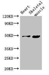 Western Blot Positive WB detected in: Mouse heart tissue, Mouse skeletal muscle tissue All lanes: EDNRB antibody at 4µg/ml Secondary Goat polyclonal to rabbit IgG at 1/50000 dilution Predicted band size: 50, 49, 60 kDa Observed band size: 50 kDa