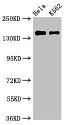 Western Blot Positive WB detected in: Hela whole cell lysate, K562 whole cell lysate All lanes: EEA1 antibody at 3µg/ml Secondary Goat polyclonal to rabbit IgG at 1/50000 dilution Predicted band size: 163 kDa Observed band size: 163 kDa