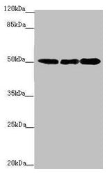 Western blot All lanes: EEF1A2 antibody at 2.23µg/ml Lane 1: MCF-7 whole cell lysate Lane 2: Hela whole cell lysate Lane 3: Raji whole cell lysate Secondary Goat polyclonal to rabbit IgG at 1/10000 dilution Predicted band size: 50 kDa Observed ban...