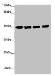 Western blot All lanes: EEF1A2 antibody at 1.46µg/ml Lane 1: MCF-7 whole cell lysate Lane 2: Hela whole cell lysate Lane 3: Raji whole cell lysate Lane 4: A431 whole cell lysate Secondary Goat polyclonal to rabbit IgG at 1/10000 dilution Predicted...