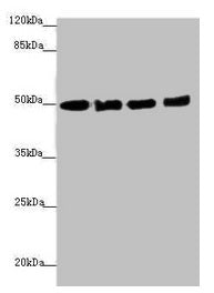 Western blot All lanes: EEF1A2 antibody at 1.46µg/ml Lane 1: MCF-7 whole cell lysate Lane 2: Hela whole cell lysate Lane 3: Raji whole cell lysate Lane 4: A431 whole cell lysate Secondary Goat polyclonal to rabbit IgG at 1/10000 dilution Predicted...