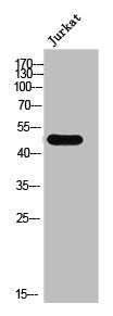 Western Blot analysis of Jurkat cells using CtBP1 Polyclonal Antibody