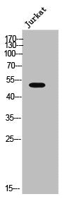 Western Blot analysis of JK cells using AR-α2A Polyclonal Antibody