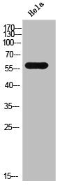 Western Blot analysis of HELA cells using ALS2CR13 Polyclonal Antibody