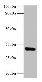 Western blot All lanes: EEF1D antibody at 2µg/ml + MCF-7 whole cell lysate Secondary Goat polyclonal to rabbit lgG at 1/15000 dilution Predicted band size: 32, 72, 29, 30 kDa Observed band size: 32 kDa