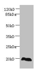 Western blot All lanes: EEF1E1 antibody at 2µg/ml + HepG2 whole cell lysate Secondary Goat polyclonal to rabbit IgG at 1/10000 dilution Predicted band size: 20, 16 kDa Observed band size: 20 kDa