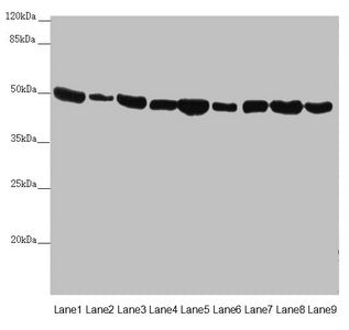 Western blot All lanes: EEF1G antibody at 0.73µg/ml Lane 1: Mouse gonadal tissue Lane 2: Mouse brain tissue Lane 3: HL60 whole cell lysate Lane 4: NIH/3T3 whole cell lysate Lane 5: PC-3 whole cell lysate Lane 6: HepG2 whole cell lysate Lane 7: Hel...