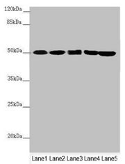 Western blot All lanes: EEF1G antibody at 0.78µg/ml Lane 1: Mouse gonadal tissue Lane 2: PC-3 whole cell lysate Lane 3: HepG2 whole cell lysate Lane 4: Hela whole cell lysate Lane 5: 293T whole cell lysate Secondary Goat polyclonal to rabbit IgG a...