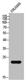 Western Blot analysis of COLO205 cells using Cathepsin G Polyclonal Antibody