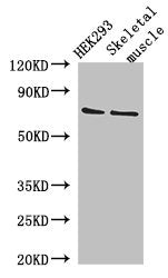 Western Blot Positive WB detected in: HEK293 whole cell lysate, Mouse skeletal muscle tissue All lanes: EFCAB7 antibody at 2.8µg/ml Secondary Goat polyclonal to rabbit IgG at 1/50000 dilution Predicted band size: 72, 70 kDa Observed band size: 72 kDa