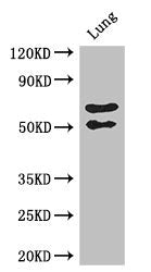 Western Blot Positive WB detected in: Mouse lung tissue All lanes: EFEMP2 antibody at 2.7ug/ml Secondary Goat polyclonal to rabbit IgG at 1/50000 dilution Predicted band size: 50 kDa Observed band size: 50, 70 kDa