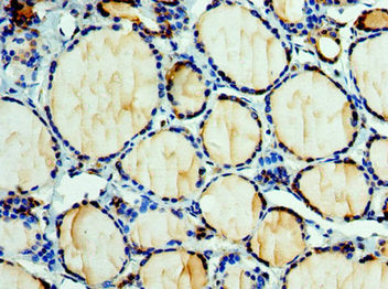 Immunohistochemistry of paraffin-embedded human thyroid tissue using CSB-PA007462ESR2HU at dilution of 1:100